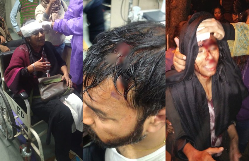 JNU: किसी का सिर फोड़ा तो किसी के तोड़े हाथ-पैर, गुंडों ने लड़कियों और प्रोफेसर्स को भी नहीं छोड़ा