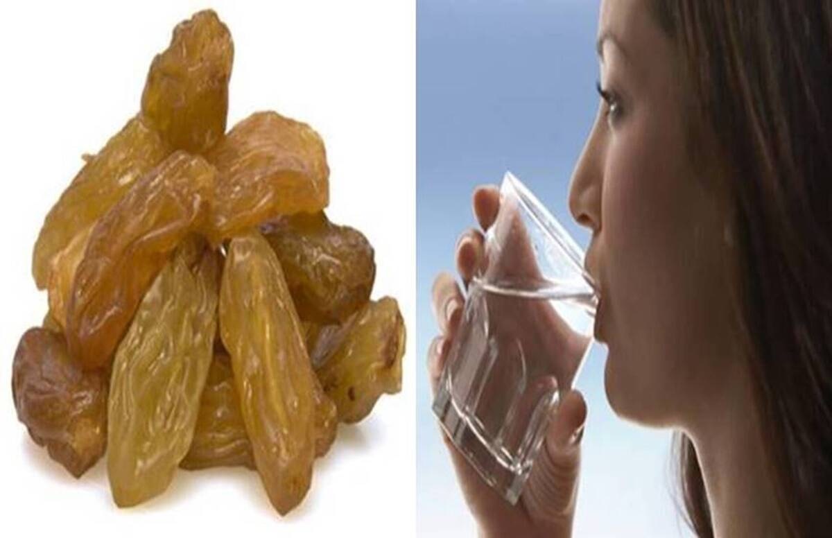 Fatty Liver के मरीजों के लिए लाभकारी है किशमिश, मुट्ठी भर खाने से होंगे