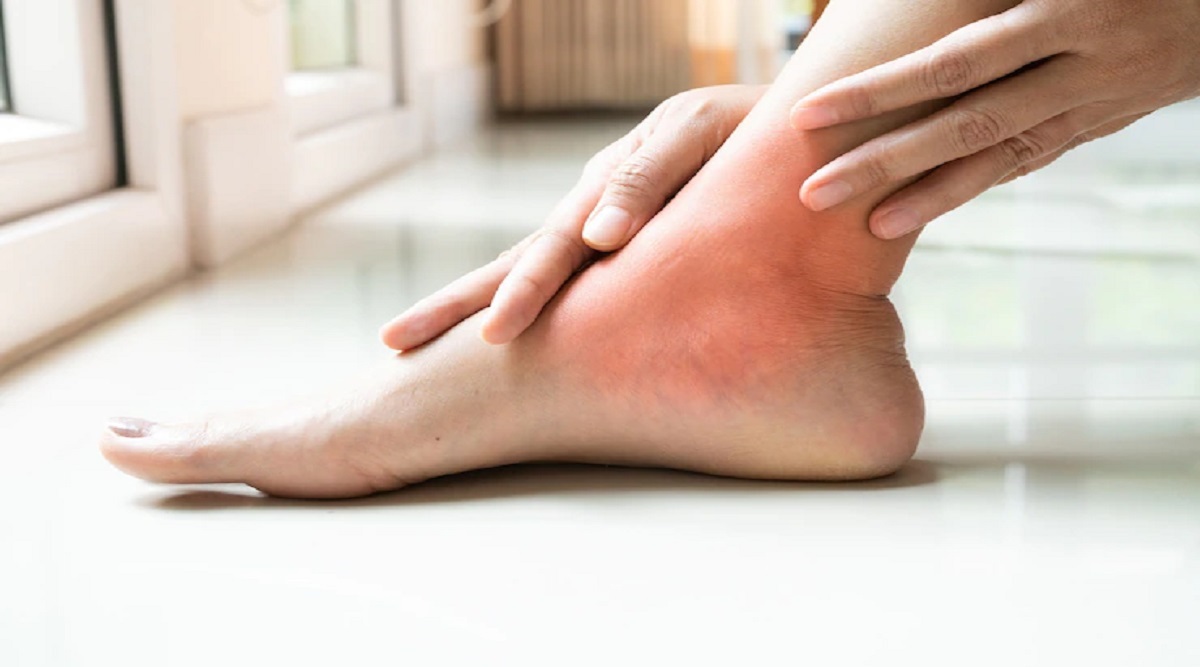 Pain and swelling in legs due to uric acid? so know the Natural Ways to