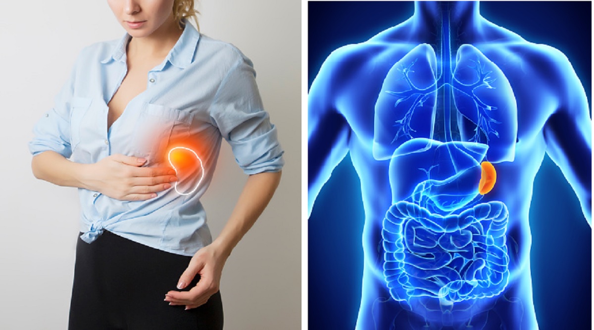 Know about the enlarged spleen causes and treatment Enlarged Spleen
