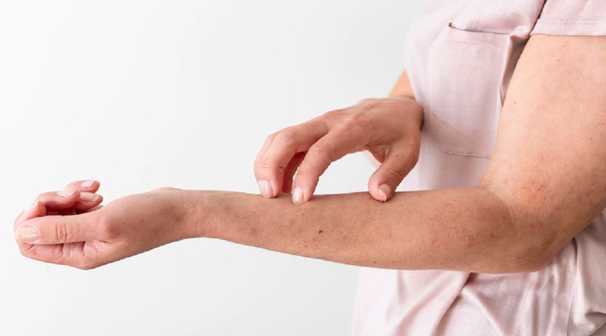 Diabetic Itching Causes, Symptoms, and Treatmentsडायबिटीज मरीजों को