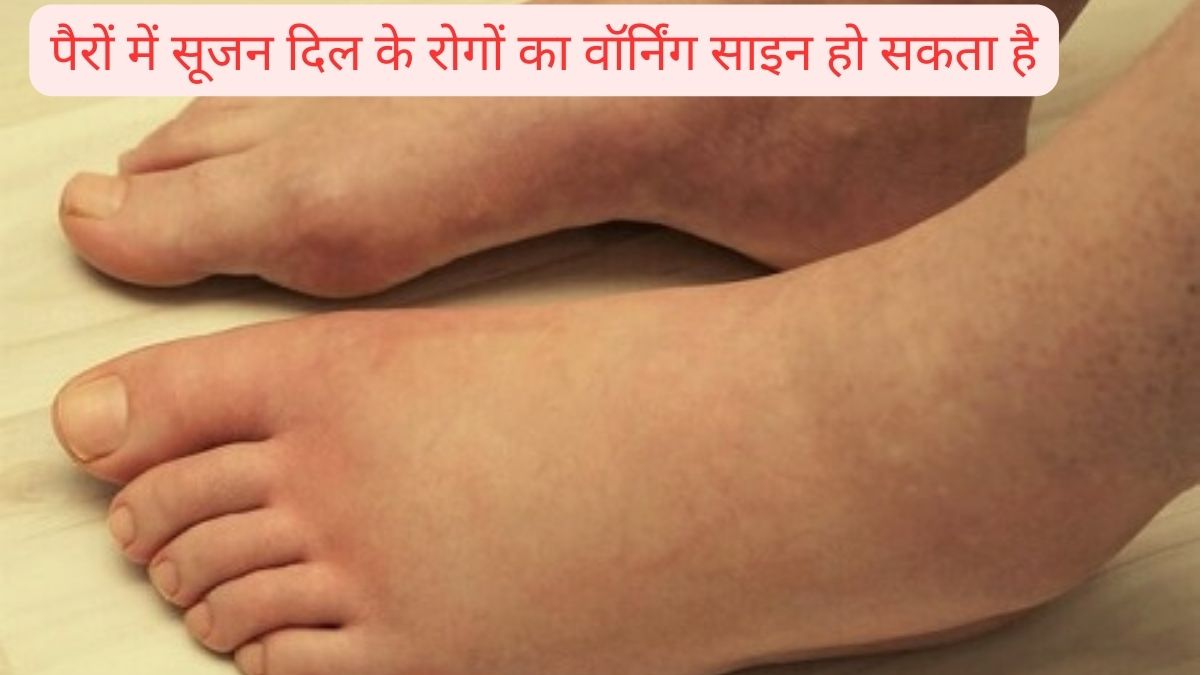 Symptoms of heart disease appear in your lower leg, edemaswelling can