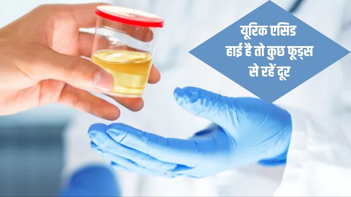 If you want to control uric acid, do not include these 5 foods in your