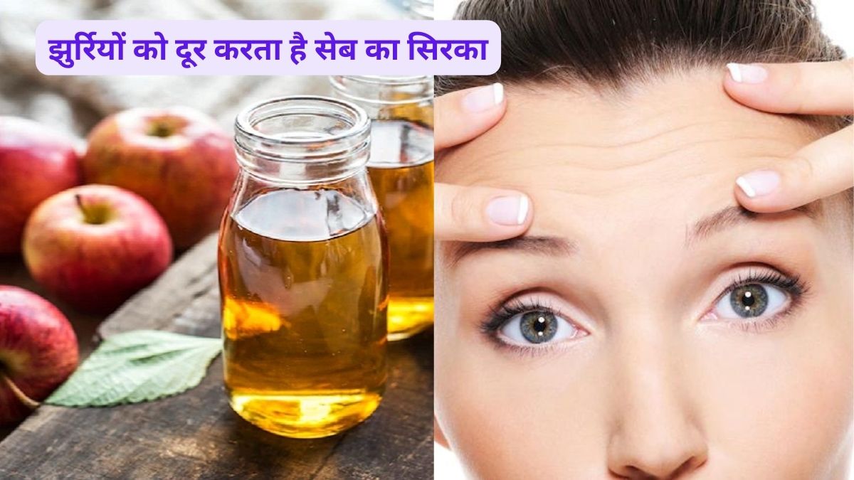 Amazing Skin Benefits of Apple Cider Vinegar Can Vinegar Remove Pimples