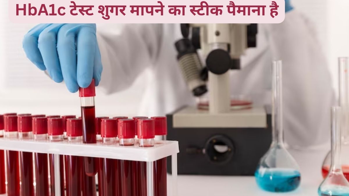 What is HbA1c test and why should a diabetic patient get it done every