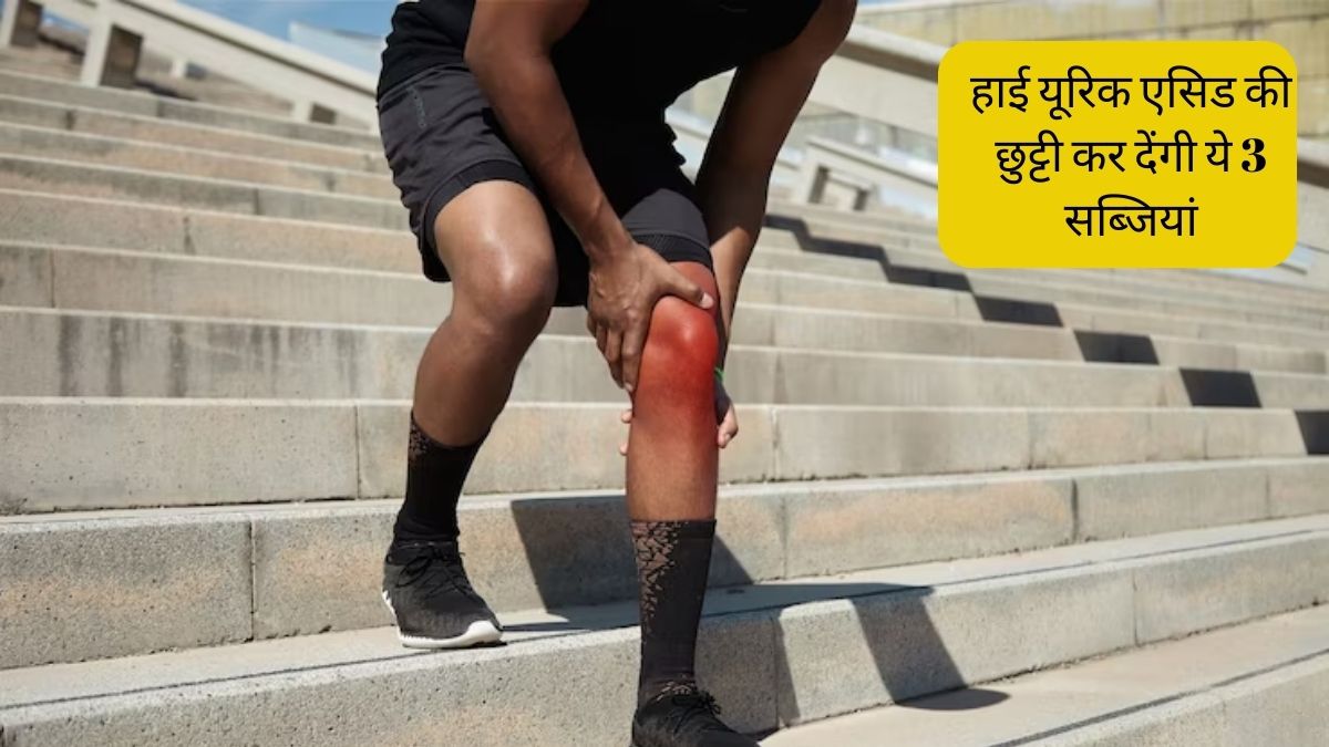 Uric Acid Home Treatment include Pumpkin Pointed gourd and Tomato in