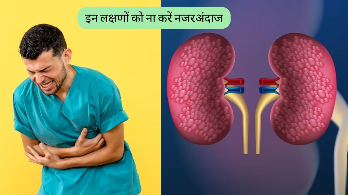 Kidney Failure Symptoms These 5 Signs Indicates You May Have Kidney