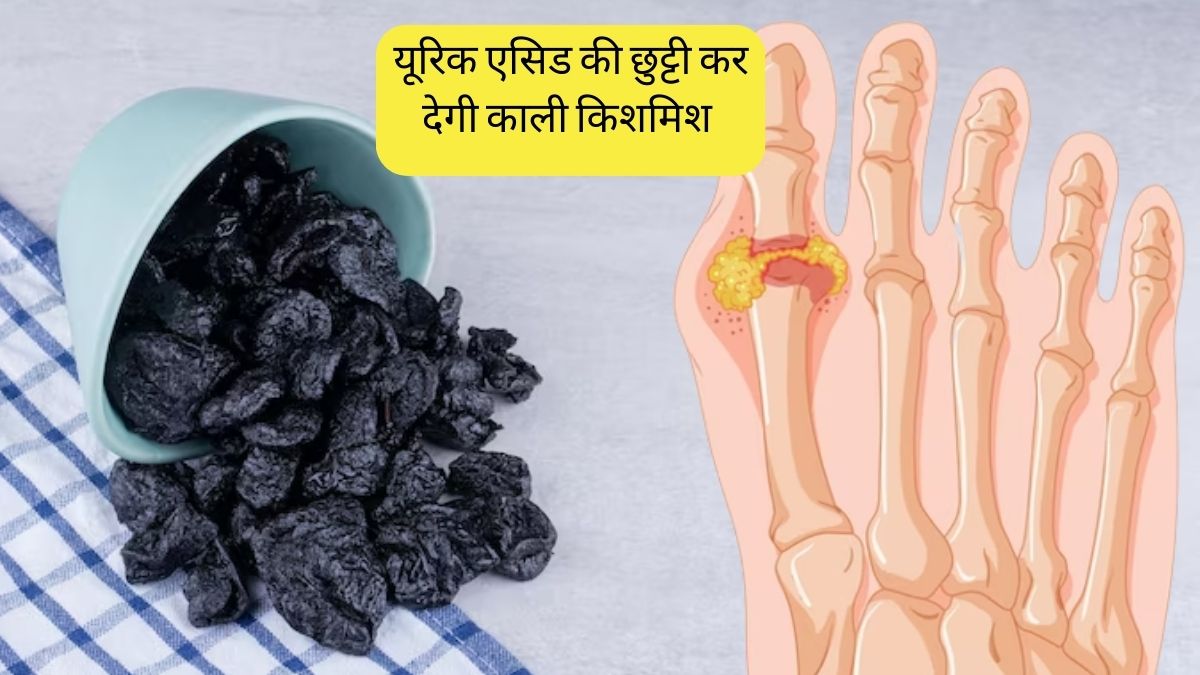 Overnight soaked black raisins Benefits for High Uric Acid And Gout know how it works Uric
