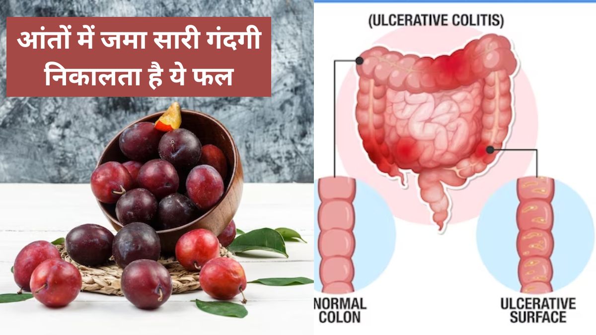 Amazing benefits of plums for constipation, cleans colon naturally at