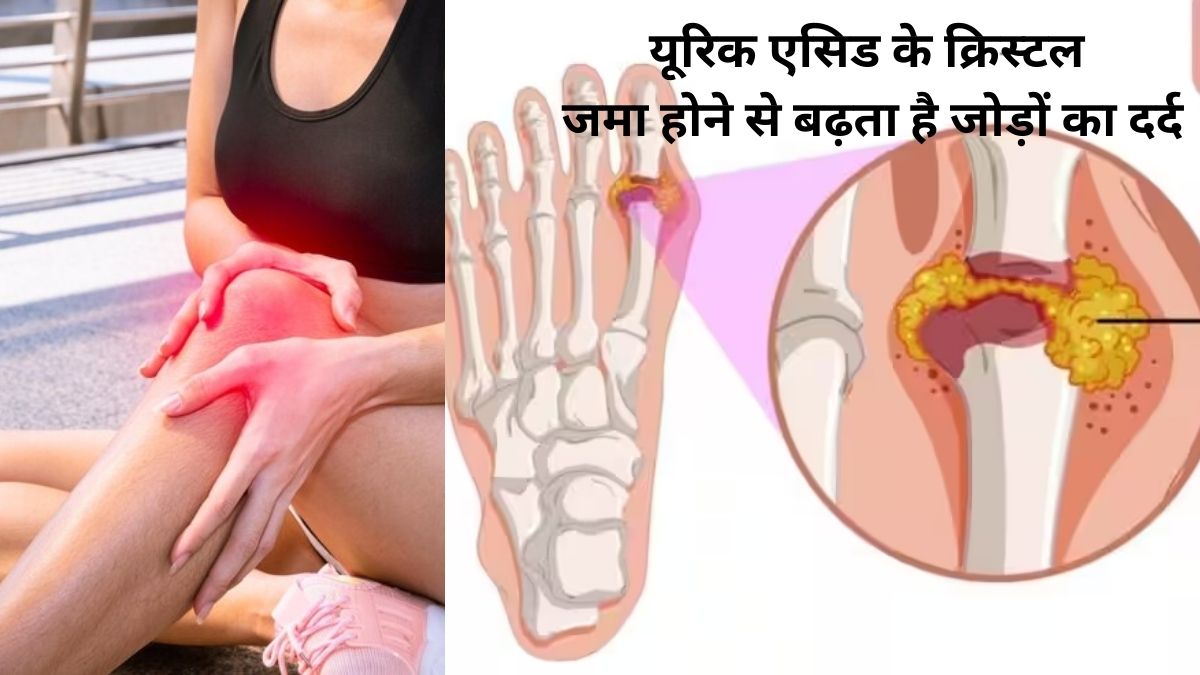 Gout Diet to get rid of joint pain and inflammation, avoid purine rich