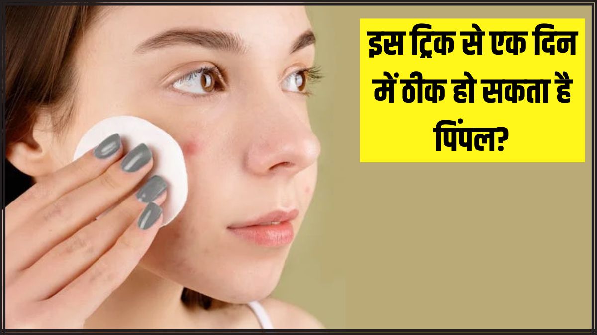 चेहरे पर पिंपल को जल्दी ठीक कैसे करें? सेलिब्रिटी डर्मेटोलॉजिस्ट ने