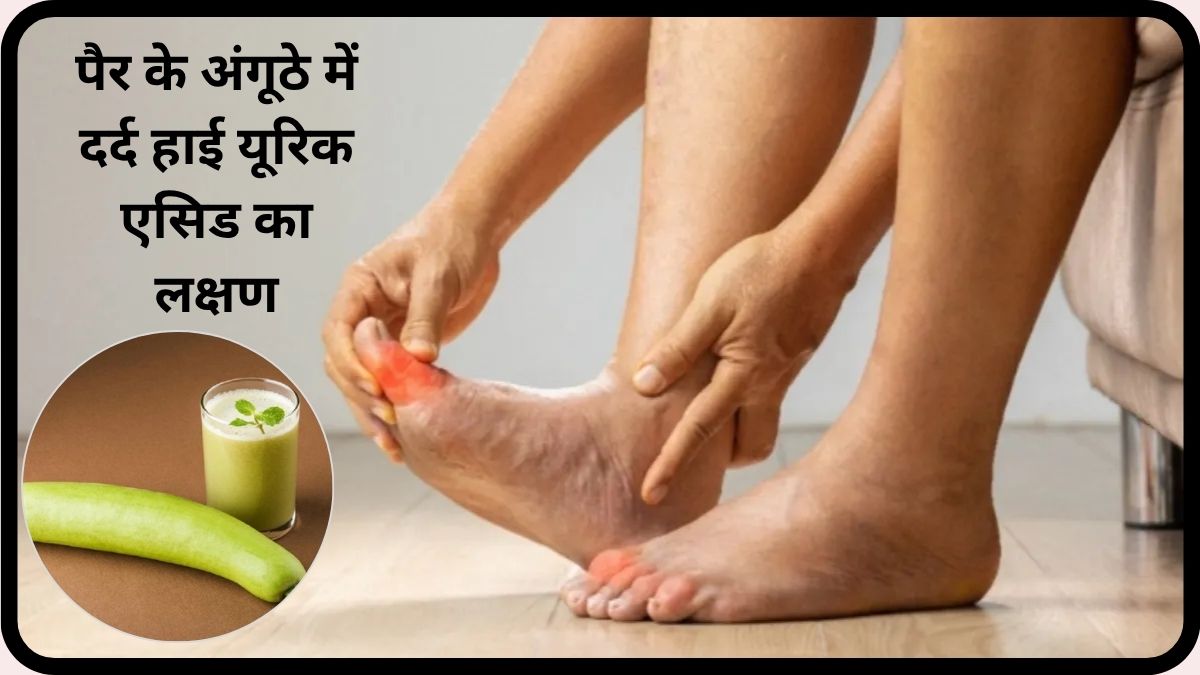 How To Make Bottle Gourd Juice, Uric Acid, bottle guard juice for uric acid control, how to make bottle guard juice at home,uric acid remedies at home